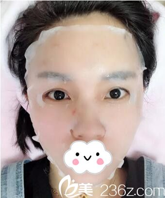 長沙美萊注射后敷面膜 長沙美萊注射后敷面膜