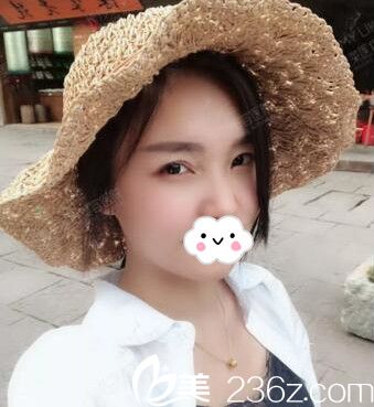 膚色暗沉還顯老，找長沙美萊劉翔做完后皮膚白嫩讓我重拾少女肌膚