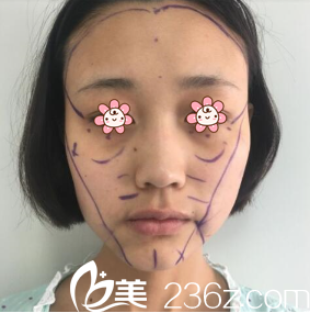 我去了韓國HG醫(yī)療整形美容外科面診 我去了韓國HG醫(yī)療整形美容外科面診