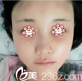 LEE CHONG RYANG院長給我做完手術(shù)后第四天 LEE CHONG RYANG院長給我做完手術(shù)后第四天