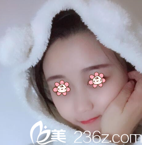 下面是我在韓國(guó)HG醫(yī)療整形LEE CHONG RYANG那兒做自體脂肪全臉填充的感受。