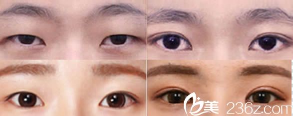 韓國(guó)然美之眼綜合整形<span style=