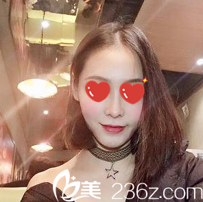 找韓國(guó)美藝整形醫(yī)院金明勛做假體隆鼻+自體脂肪填充面部2個(gè)月了恢復(fù)效果還不錯(cuò) 跟大家分享一下