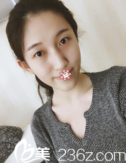 我的術(shù)前照 我的術(shù)前照