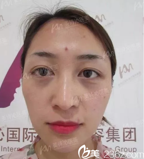 20180803_1533286360515145.png image.png