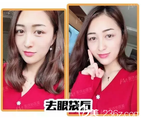 20180803_1533286473211390.png image.png