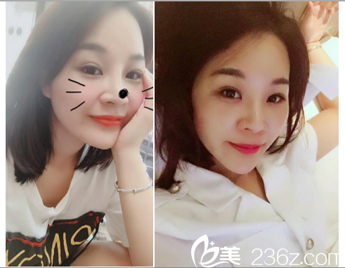 宋國(guó)強(qiáng)眼綜合手術(shù)