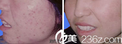 韓國ROCOCO皮膚美容效果 韓國ROCOCO皮膚美容效果