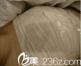 術后三天被包得嚴嚴實實