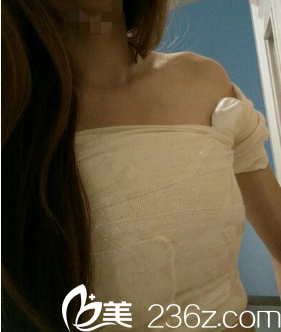 尹盛浩院長給我做完手術第六天