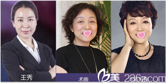 北京美萊王秀祛斑美膚<span style=