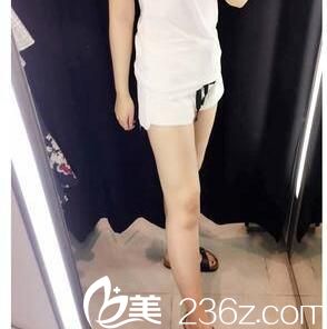 分享我2個(gè)月前找韓國(guó)美人整形醫(yī)院樸元奎做的吸脂瘦大腿恢復(fù)效果圖
