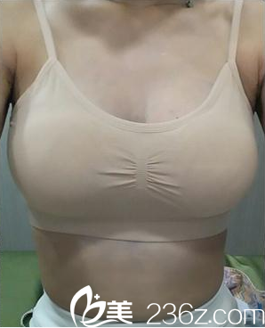 術后一周 術后一周