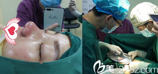 趙章杰綜合隆鼻手術(shù)過程中