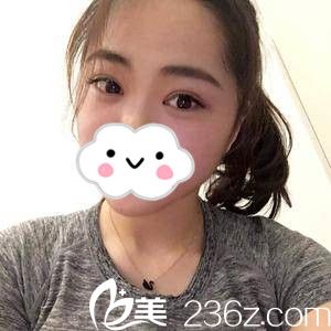 術(shù)后半個月