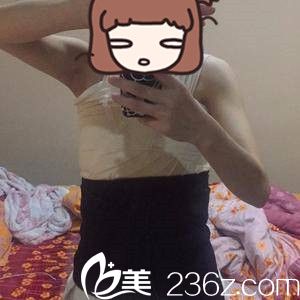 手術(shù)后第三天