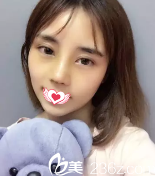 鼻綜合7天后鼻子慢慢消腫