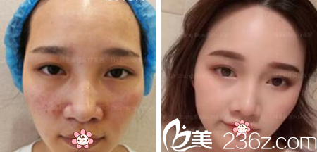 央金主任光電美膚案例 央金主任光電美膚案例