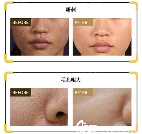 金蓓蕾醫(yī)生擅長推薦DPL<span style= 金蓓蕾醫(yī)生擅長推薦DPL<span style=