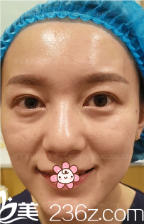 術前的我 術前的我