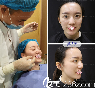 周業(yè)松院長給我做的手術 周業(yè)松院長給我做的手術