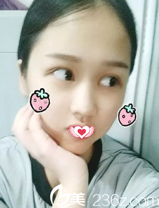 眼綜合12天手術(shù)痕跡消失 眼綜合12天手術(shù)痕跡消失