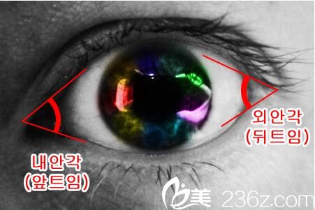 韓國(guó)李喜文整形醫(yī)院李喜文開(kāi)眼角 韓國(guó)李喜文整形醫(yī)院李喜文開(kāi)眼角