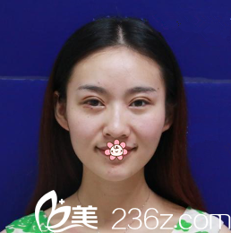 文晶煥院長給我術(shù)后第四天