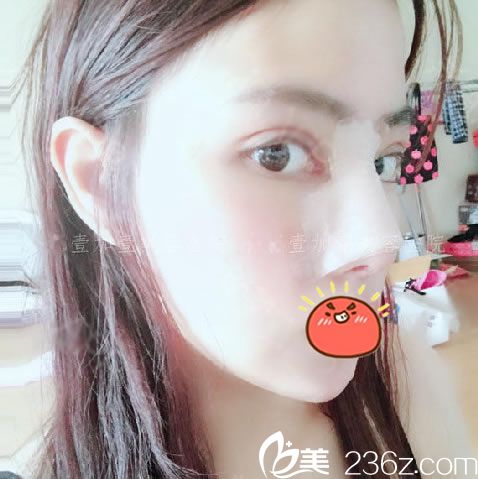 寧波壹加壹郭光燁隆鼻7天<span style= 寧波壹加壹郭光燁隆鼻7天<span style=