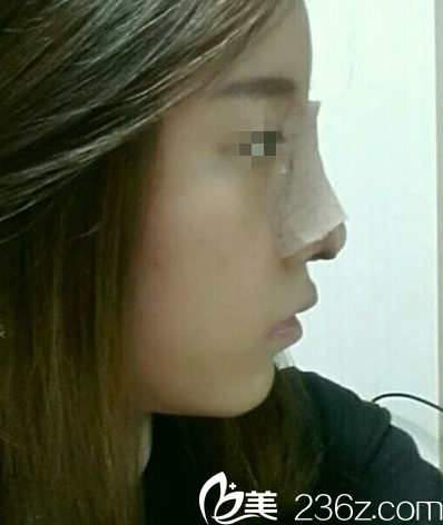 手術(shù)后第五天 手術(shù)后第五天