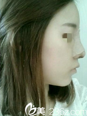 術(shù)后第二天 術(shù)后第二天