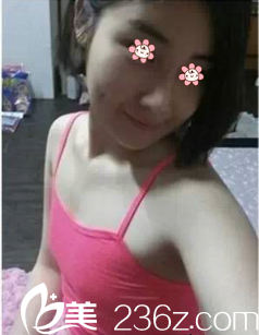 術前的我 術前的我