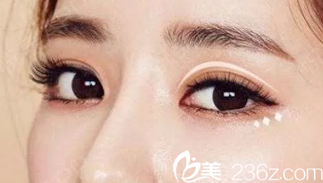 眼部整形美學(xué) 眼部整形美學(xué)