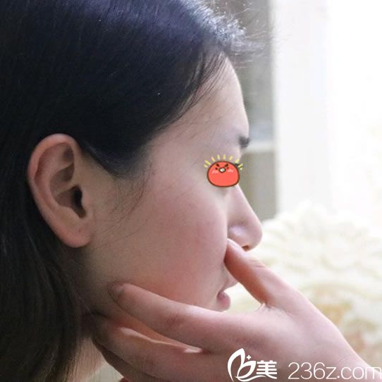 時光美極康樹勇院長面診過程