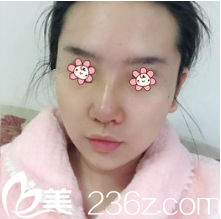 一周拆線 一周拆線