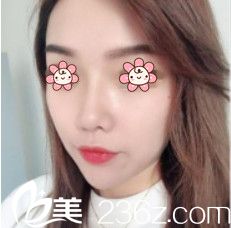 術(shù)后兩個(gè)月效果 術(shù)后兩個(gè)月效果