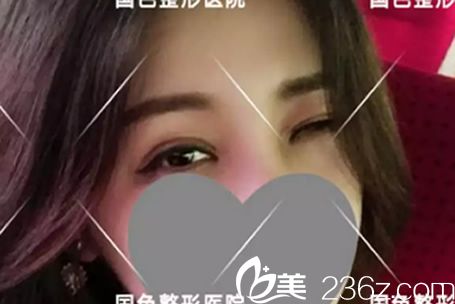 對比了蚌埠國色和韓麗的整形價格/案例后，我讓程德新給我做了全切雙眼皮+開眼角