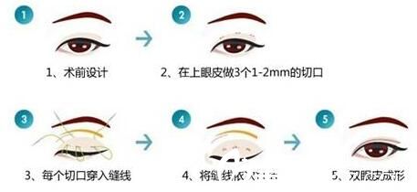 韓國休&美整形外科<span style=