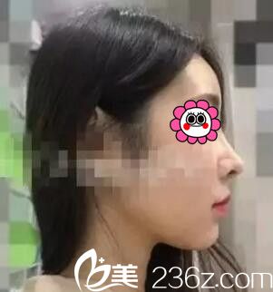 找懷化韓美做鼻綜合一個月<span style= 找懷化韓美做鼻綜合一個月<span style=