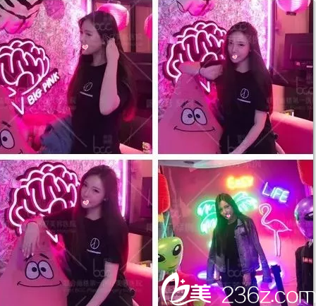 北京聯(lián)合麗格3D童顏脂肪精雕術(shù)半個(gè)月效果 北京聯(lián)合麗格3D童顏脂肪精雕術(shù)半個(gè)月效果