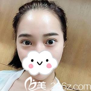 手術(shù)23天后的我 手術(shù)23天后的我