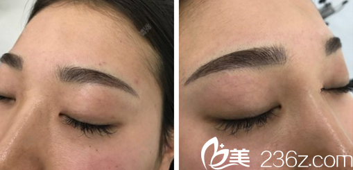 崔貴東院長做的半紋眉恢復(fù)7天 崔貴東院長做的半紋眉恢復(fù)7天