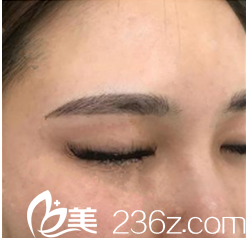 眉毛稀疏在韓國QT女性整形找崔貴東院長做半紋眉后眉目如畫