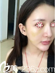 <!--<i data=20240703-sp></i>-->院長(zhǎng)給我做完手術(shù)第五天