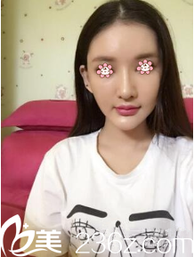 術(shù)后半個(gè)月