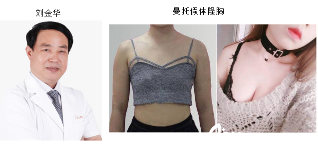 北京美萊劉金華及其假體隆胸 北京美萊劉金華及其假體隆胸