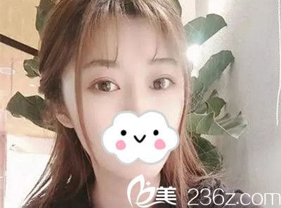 我是得知崔錫勛在韓國狎鷗亭艾薇整形外科擔(dān)任院長，才慕名去做的雙眼皮手術(shù)