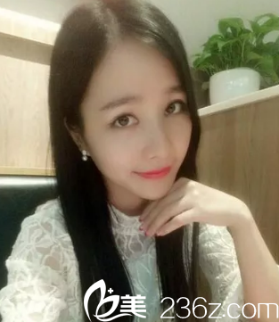 直播青島諾美德美容整形醫(yī)院昌紅醫(yī)生給我做的全切雙眼皮圖片