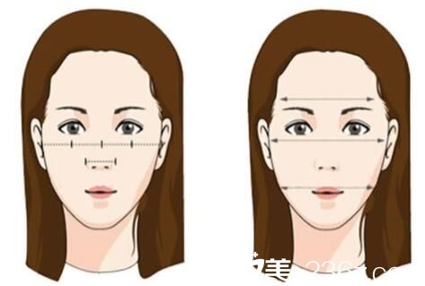 韓國張益秀整形外科顴骨整形 韓國張益秀整形外科顴骨整形