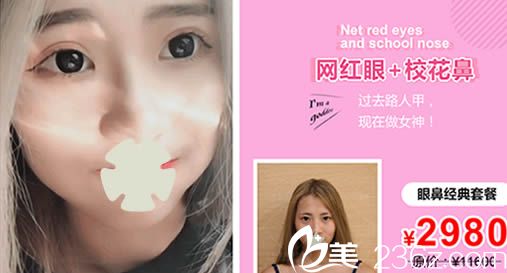 重慶聯(lián)合麗格雙眼皮+隆鼻效果對比圖 重慶聯(lián)合麗格雙眼皮+隆鼻效果對比圖